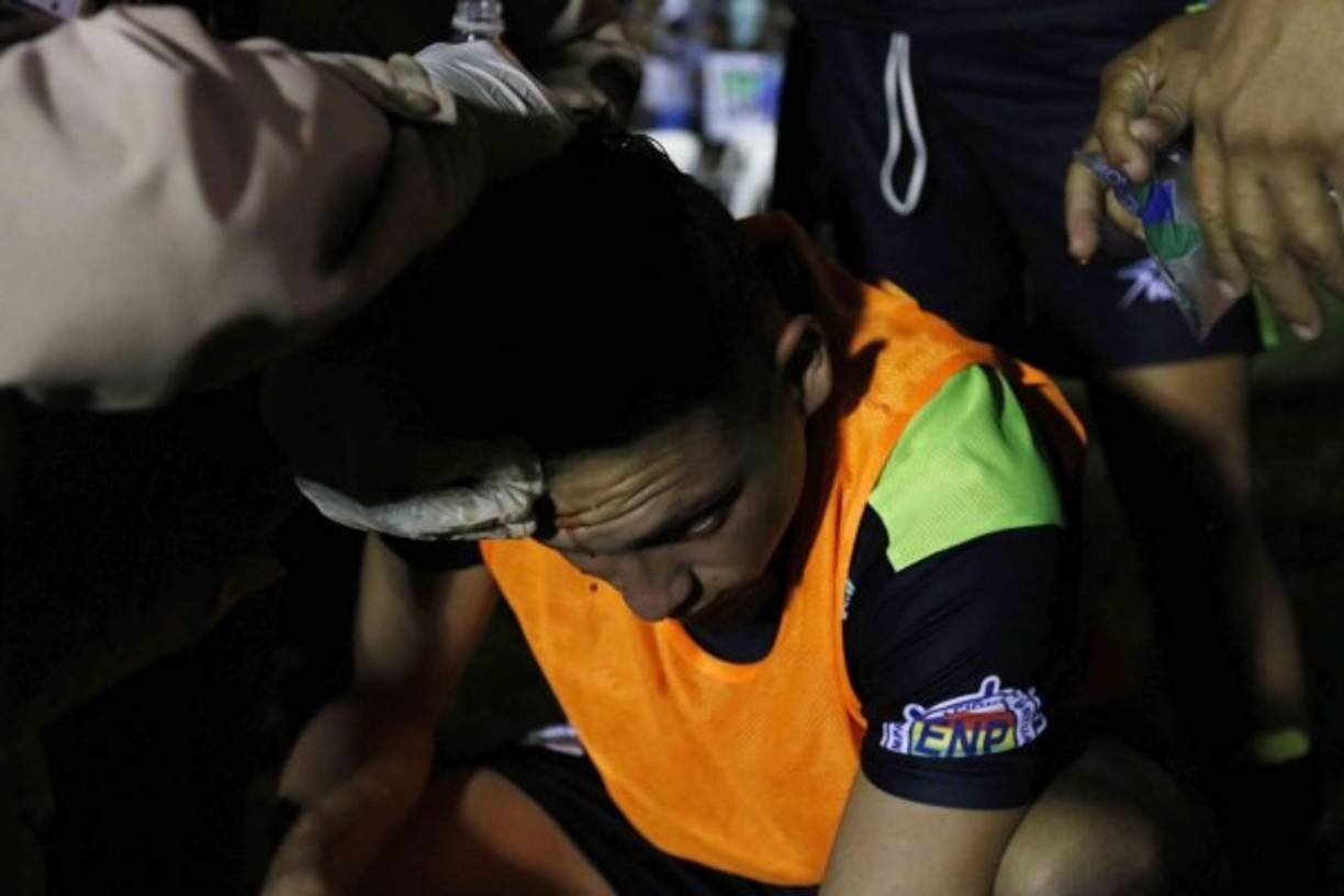 Un futbolista suplente del Platense fue víctima de una penosa agresión cuando le lanzaron una lata de cerveza llena a la cabeza, justo en el festejo el primer gol escualo ante Yoro FC.