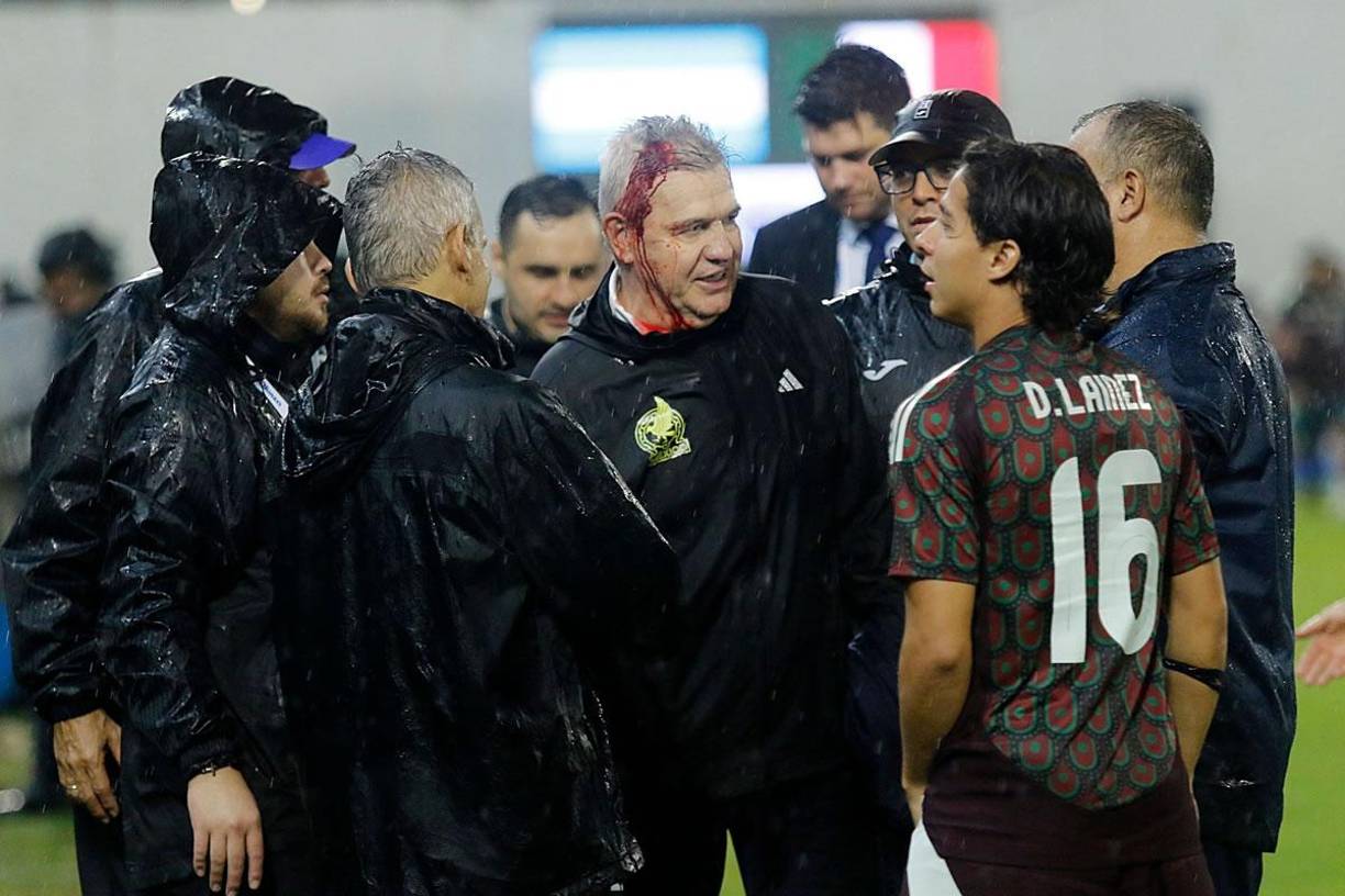 La agresión le abrió una herida en la cabeza al ‘Vasco‘ Aguirre que se fue ensangrentado del campo.