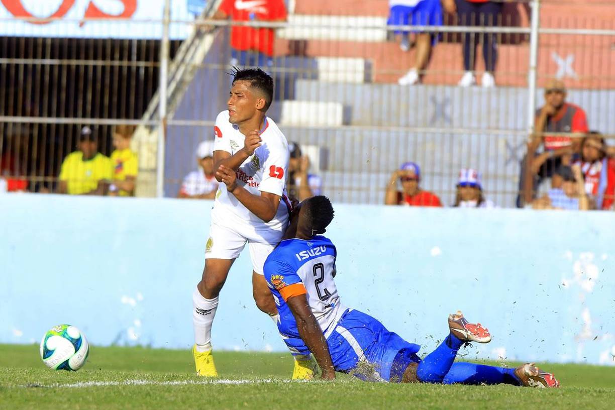 El defensa José David Velásquez Colón se llevó este tremendo golpe en el rostro en una acción en la que le cometió falta a José Mario Pinto.