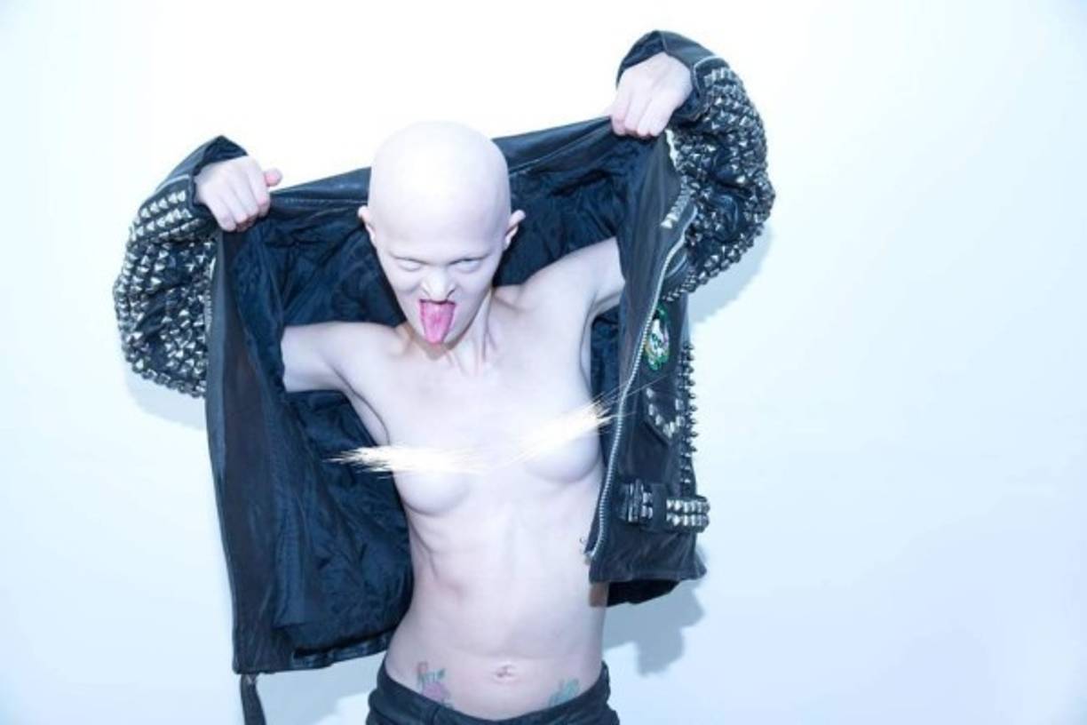 'La gente solía preguntarme: ¿Cómo se come sin dientes? Bueno, la gente sin piernas corre maratones. Todo es cuestión de percepción.'