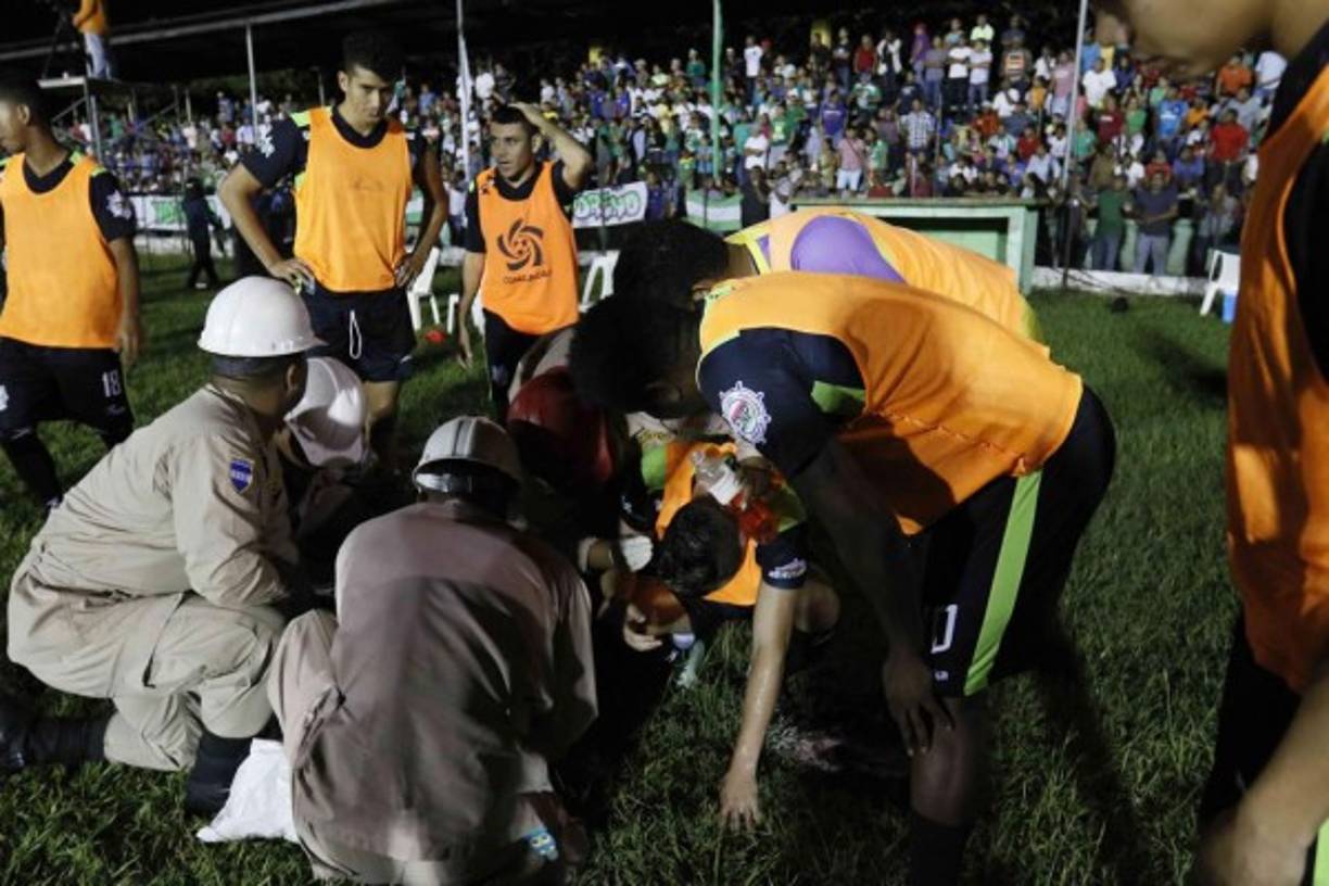 Un futbolista suplente del Platense fue víctima de una penosa agresión cuando le lanzaron una lata de cerveza llena a la cabeza, justo en el festejo el primer gol escualo ante Yoro FC.