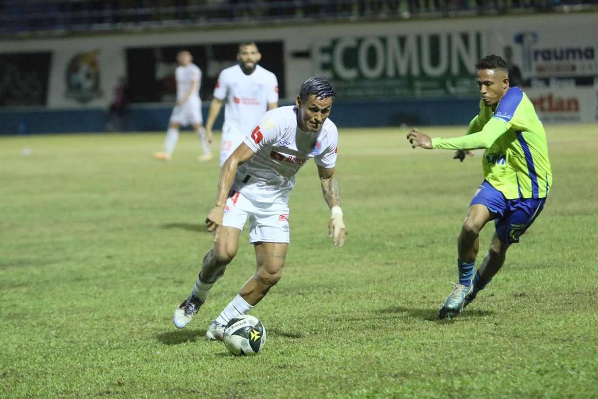 A pesar de la tormenta en Juticalpa, Andy Nájar no perdió su colorido look en el partido contra Olancho FC: