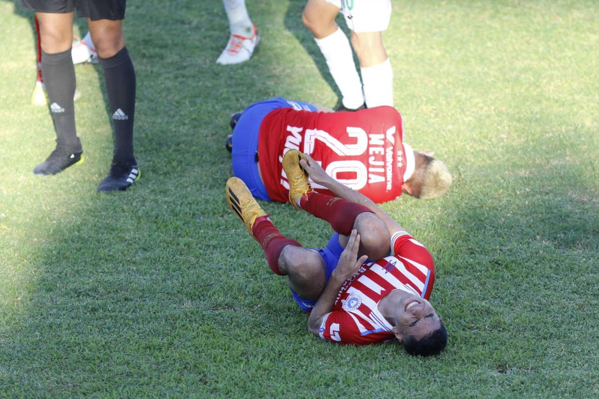 El defensa del conjunto verdolaga fue expulsado por una horrible entrada a dos futbolistas de los Albos en los minutos finales del partido.