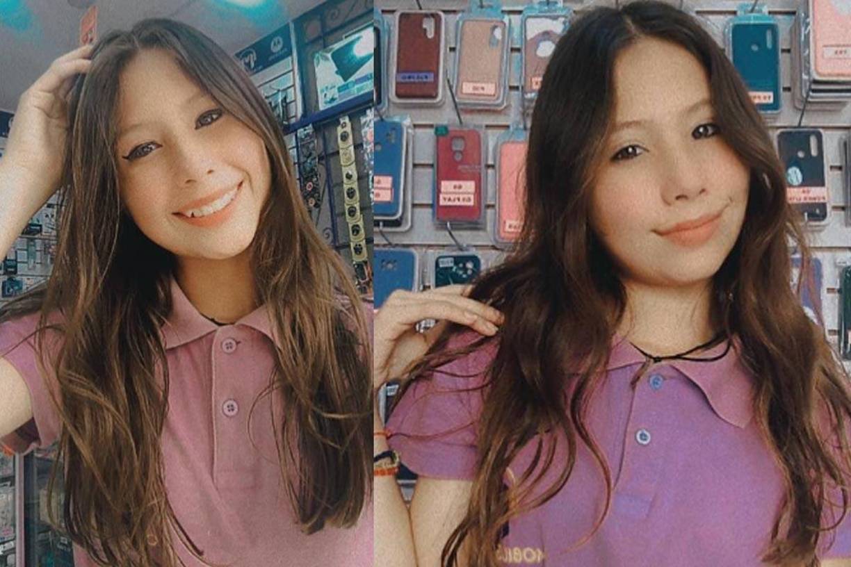 Leidy acudió a la <b>clínica Kiru Dent’s, Perú, </b>el pasado 9 de enero y, días después, presentó dificultades para respirar e hinchazón en el cuello.