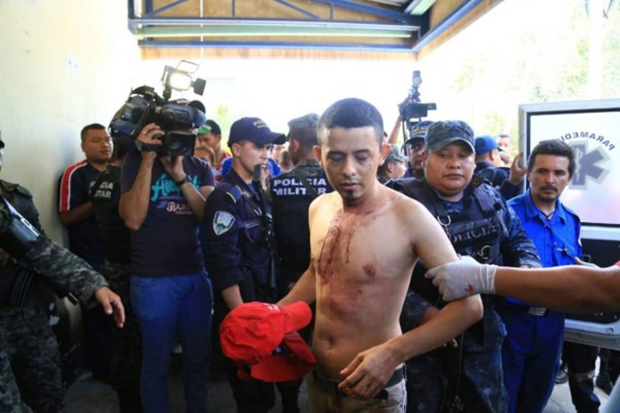 Un total de 33 reclusos heridos fueron atendidos en el hospital Mario Rivas de San Pedro Sula.