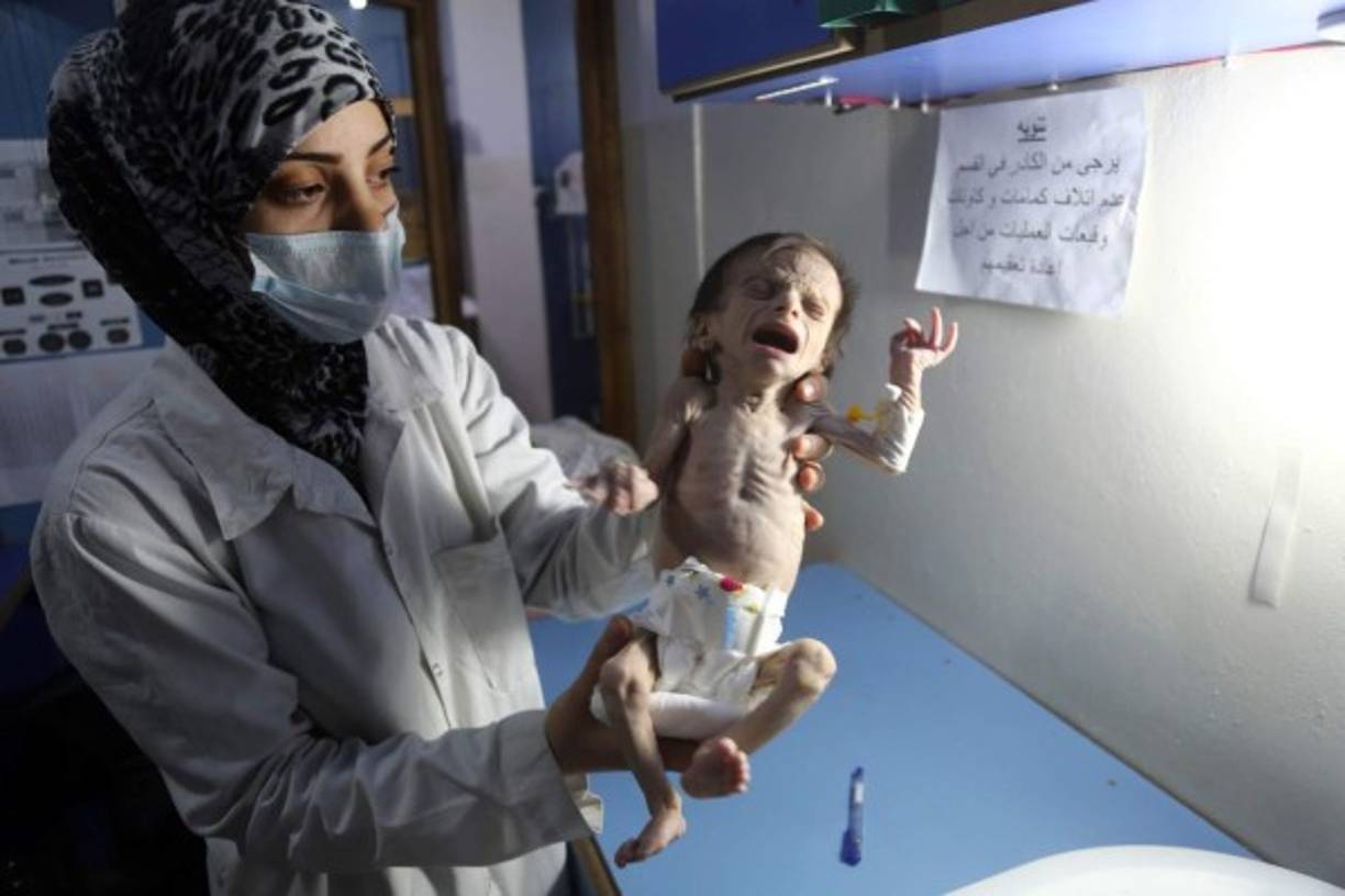 'Los suministros son muy escasos y si esto continúa más niños morirán', dijo un funcionario de los organismos de ayuda humanitaria, que prefirió mantener el anonimato, al periódico británico The Guardian.<br/><br/>