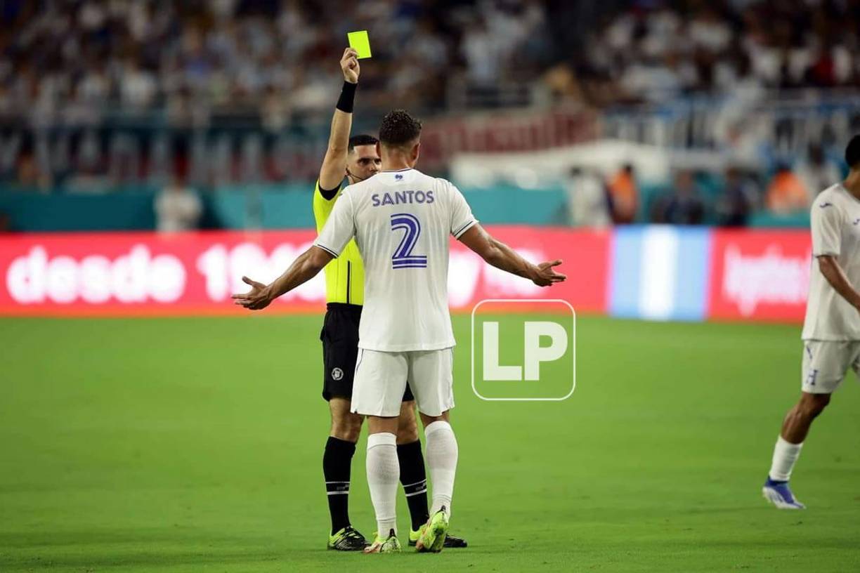 Marcelo Santos fue uno de los amonestados en la Selección de Honduras durante el partido ante Argentina.
