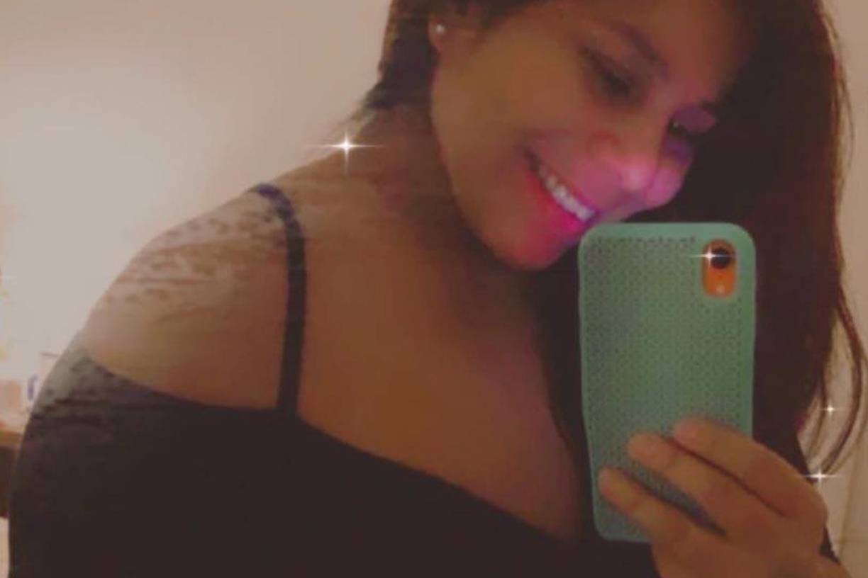 La niña pesaba 13 libras, lo que representa una disminución de 7 libras desde su última visita al médico menos de dos meses antes de su deceso, añadió la forense.