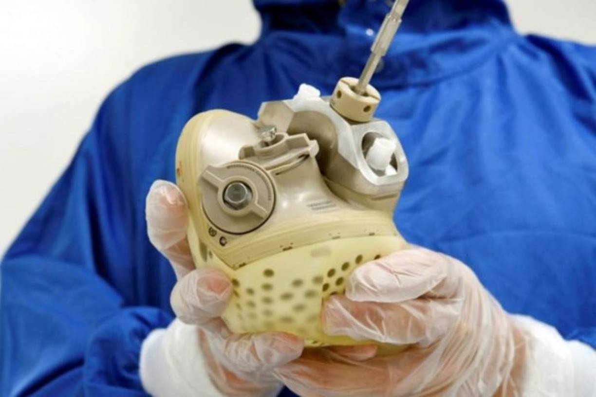 La prótesis está desarrollada a partir de los componentes, tanto orgánicos, como materiales utilizados en la industria aérea.