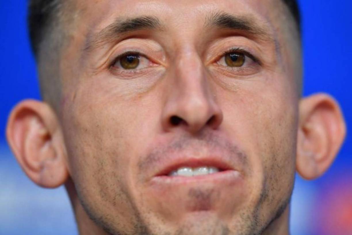 Así lucía Héctor Herrera antes de las operaciones estéticas que se hizo, donde destacan la de las orejas y nariz.