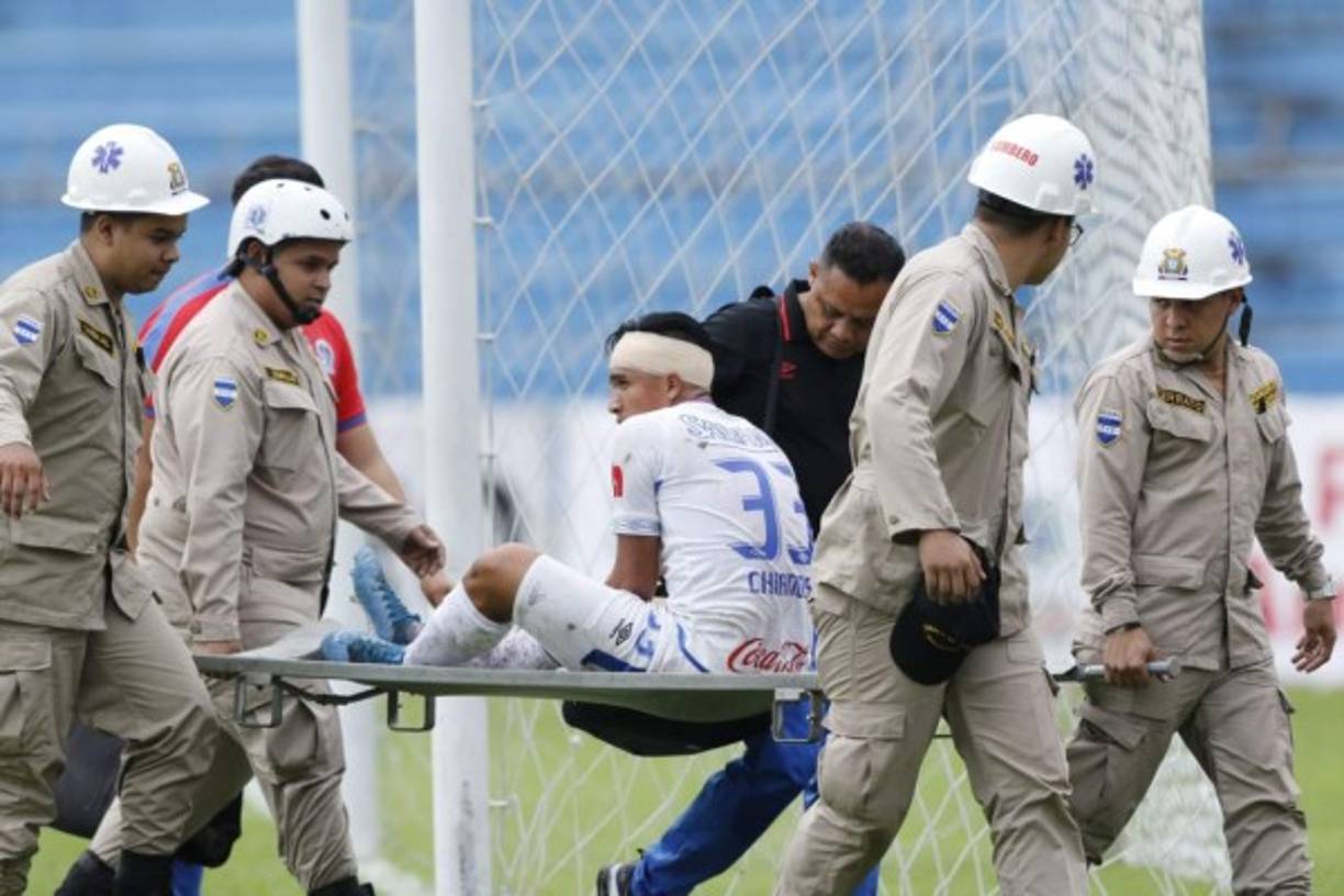 Michaell Chirinos salió del campo en camilla tras llevarse un golpe.