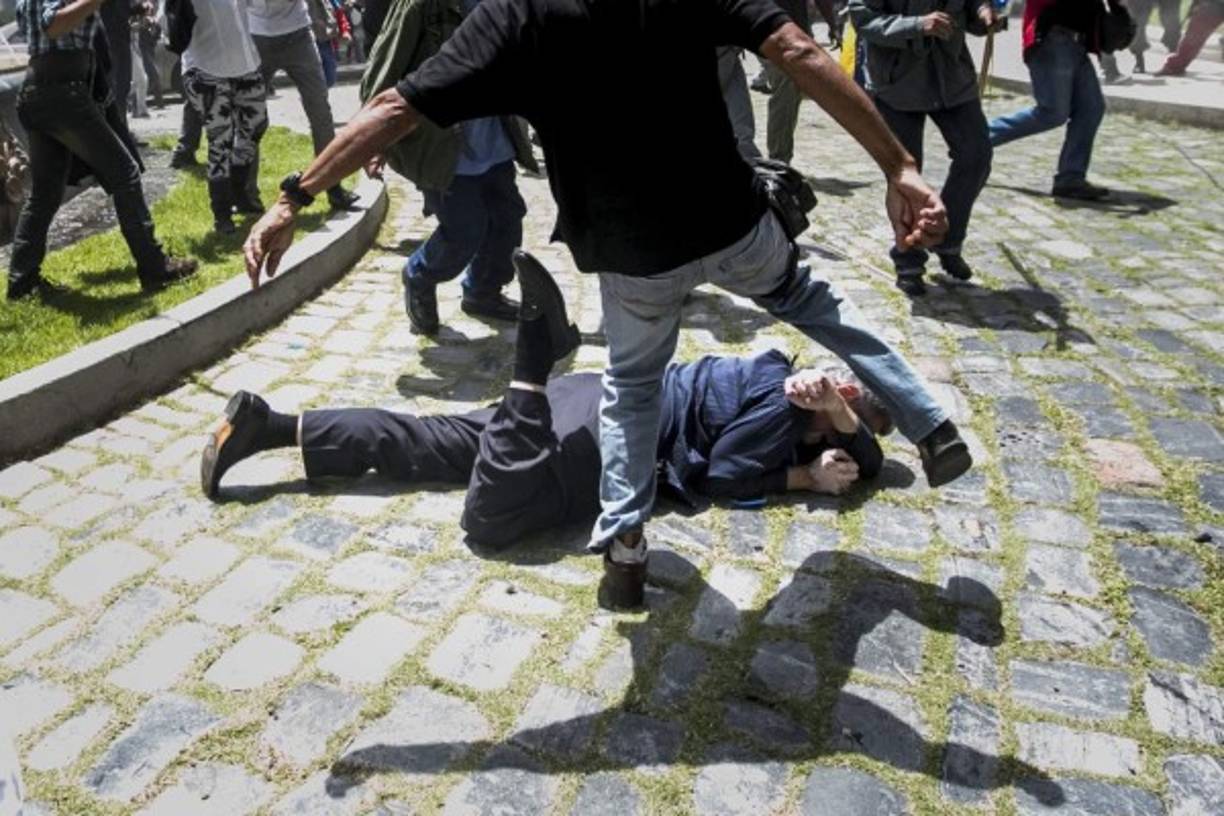 El diputado Américo De Grazia fue uno de las víctimas de la violenta turba chavista que asaltó la Asamblea Nacional.