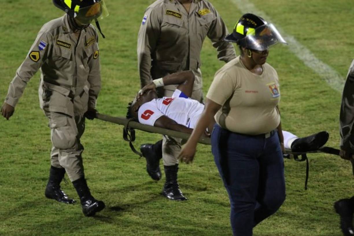 El delantero Júnior Lacayo salió lesionado en el minuto 32 de la primera parte. El atacante fue reemplazado por Alejandro Reyes, de momento se conoce qué tan grave podría ser su lesión.