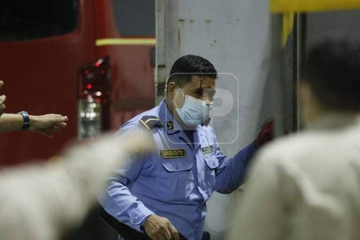 Elementos de la Policía Nacional resultados heridos tras los disturbios realizados por barristas del Real España y Marathón.