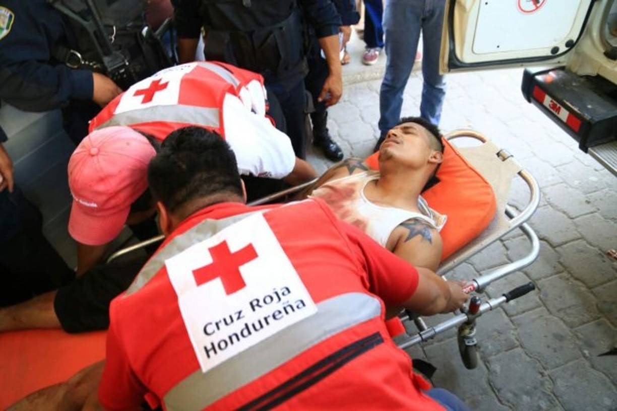 Los 33 privados de libertad presentan heridas de bala y piedras.