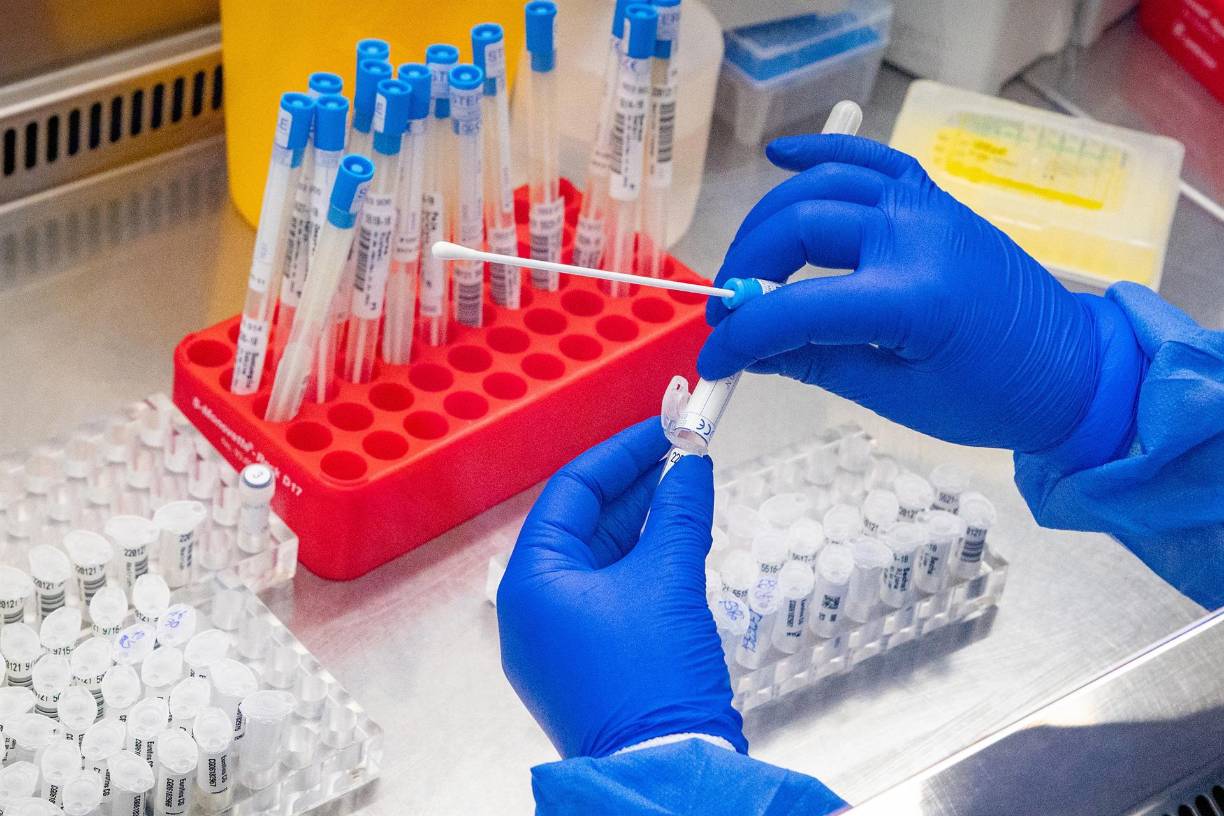 La declaración de emergencia internacional, indicó el máximo responsable de la OMS, incluye recomendaciones de distinto tipo a los países según hayan detectado o no casos, o si hay ya focos de transmisión local.