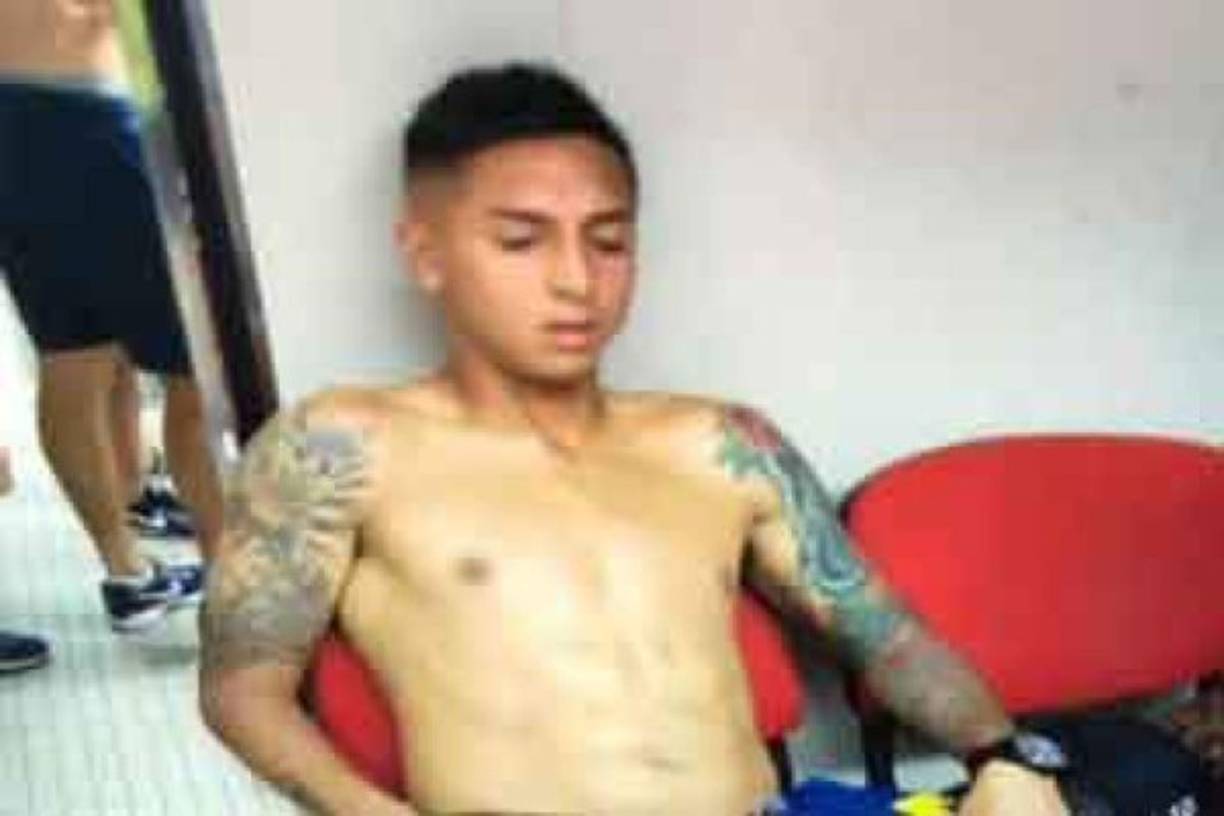 Agustín Almendra, mediocampista de Boca Juniors, fue uno de los afectados tras la agresión de los aficionados de River.