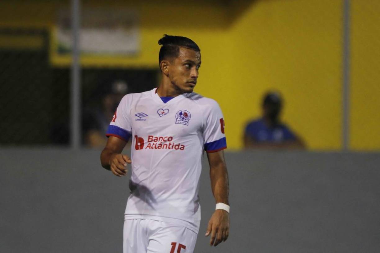 “Si llega una oferta, el equipo va a analizarla, pero por los momentos estoy feliz en el Olimpia. A mí no me han dicho nada, solo son rumores, es falso y si han caído, es la directiva que maneja eso. Yo estoy feliz en la institución”, esas fueron las palabras de Edwin Rodríguez tras rumores que sería nuevo legionario hondureño.