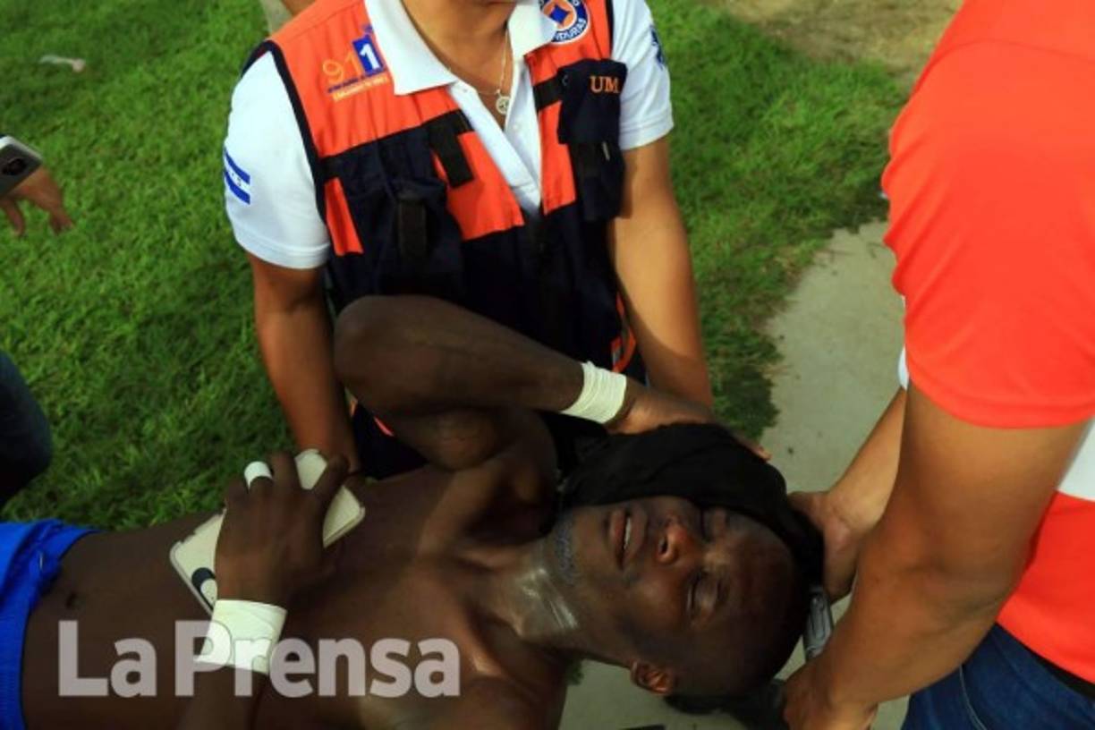 Rubilio Castillo se fue al camerino, pero tuvo que ser asistido y trasladado en camilla a una ambulancia para ser llevado a una clínica.