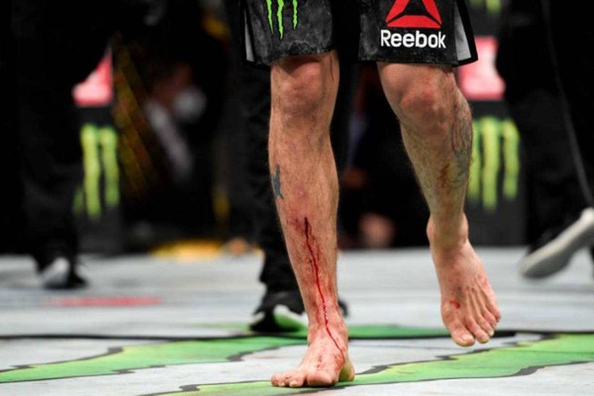 La sangre estuvo presente en cada pelea.