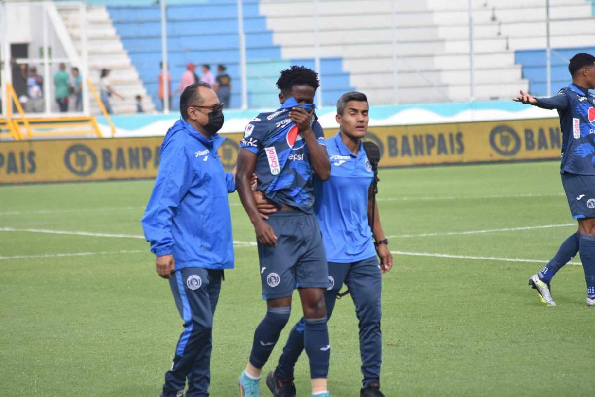 El jugador del Motagua se tomó las manos a la cabeza, luego se llevó su camiseta a los ojos y empezó a llorar porque la lesión parece muy grave.