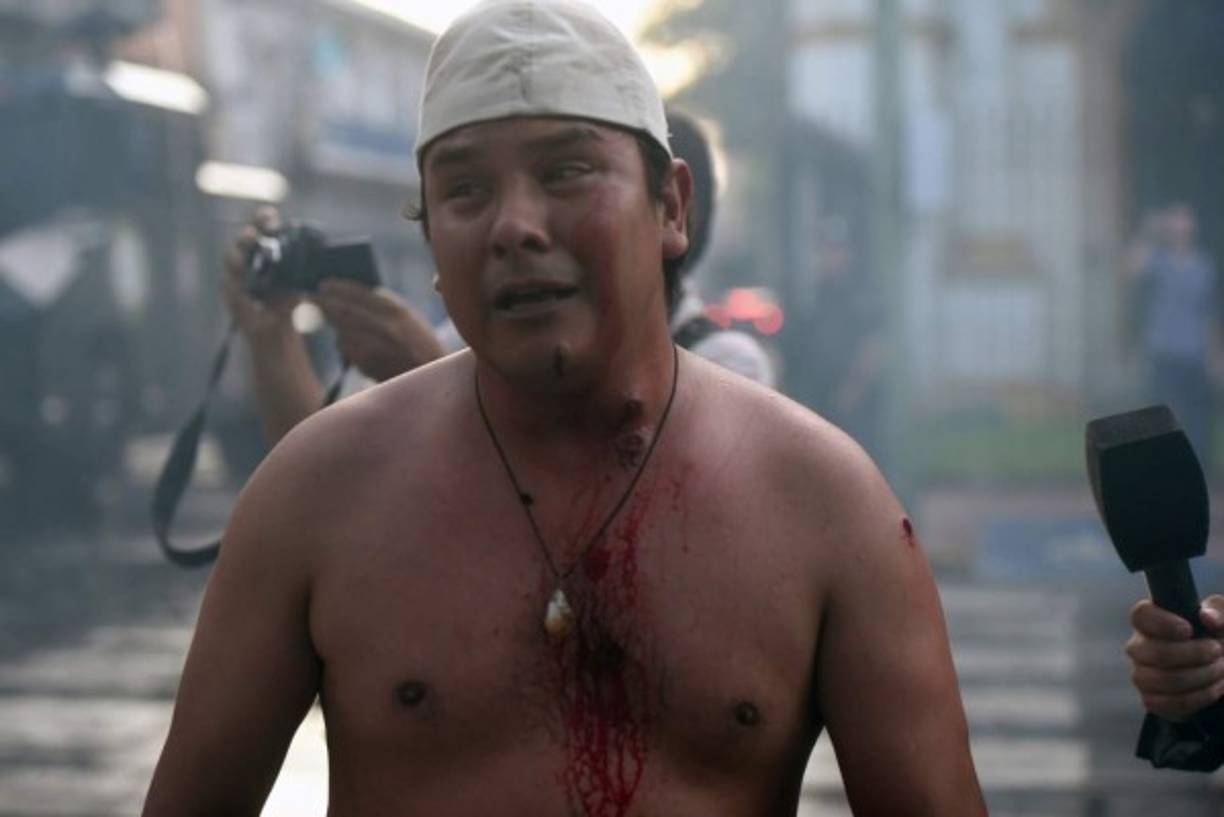 Resultando herido Efraín Alegre, presidente del opositor Partido Liberal, el mayor de la oposición.<br/>