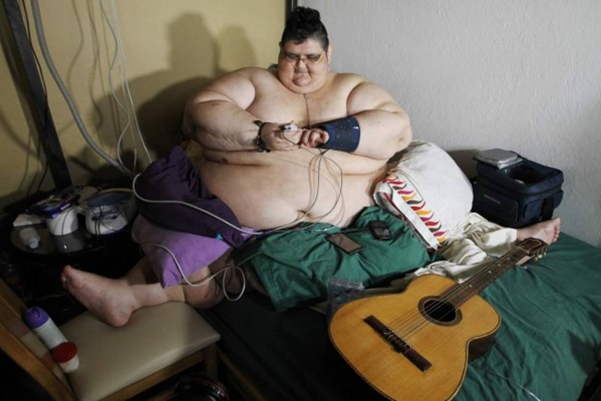GUADALAJARA. El hombre más obeso listo para cirugía. El joven Juan Pedro, mexicano que con 500 kilos es considerado como el hombre más obeso del mundo, revela detalles de su intervención quirúrgica. Foto: EFE/Ulises Ruiz Basurto