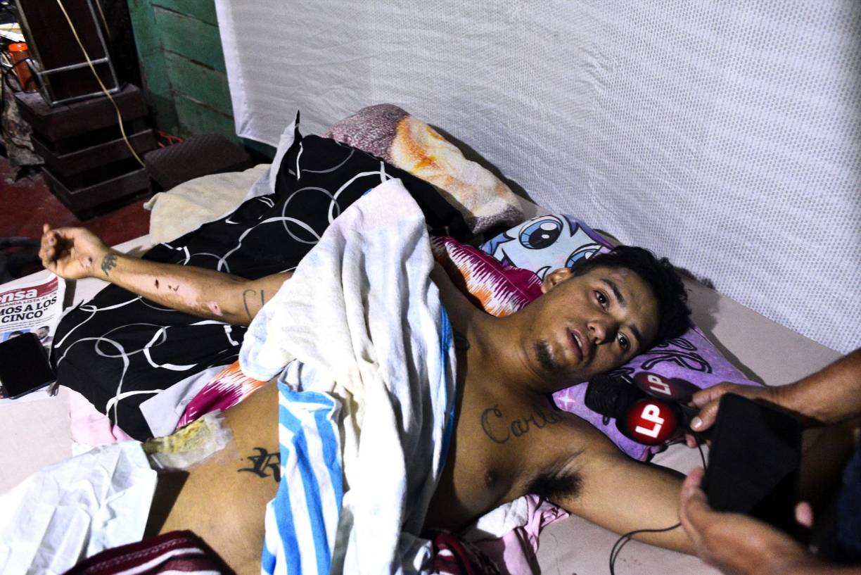 El violento hecho ocurrió el domingo 23 de julio, a eso de la 1:00 de la madrugada, en la colonia 10 de Septiembre del sector de Chamelecón.