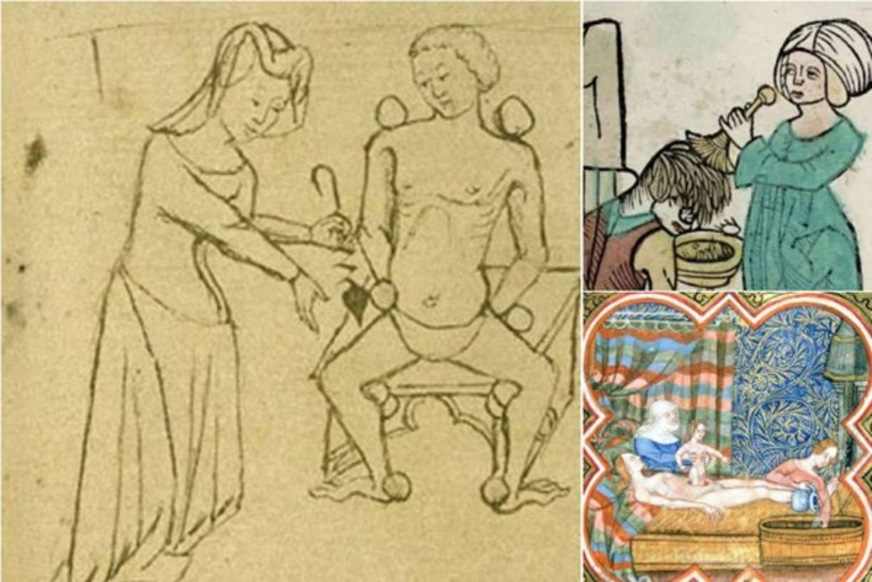 Peinados. Tanto en el siglo XVII como XVII, las mujeres tenían mucho cuidado a la hora de hacerse un peinado ya que eran muy complicados. De hecho, había barberos o peluqueros que tardaban horas en apilar sus cabellos, teniendo que usar unos soportes especiales para sujetarlos. Es por eso que las mujeres se dejaban estos peinados durante semanas o incluso meses, lo que desembocó en que gran parte de la población contrajera piojos debido a la falta de higiene. Además, también era bastante común utilizar ciertos remedios, como la ceniza o la mostaza, para lavarlos, pues en esa época no existía ningún tipo de champú. ¿Crees que aguantarías la vida en la Antigüedad?. Texto tomado de paraloscuriosos.com<br/>