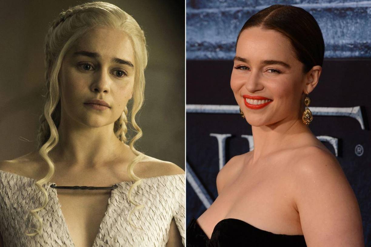 La actriz pertenece a la reducida minoría que ha sobrevivido a la ruptura de un aneurisma sin secuelas físicas y a día de hoy aún le asombra ser capaz de hablar a pesar de las lesiones cerebrales que sufrió