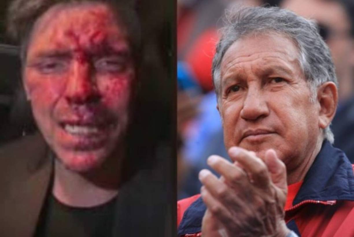 Al inicio se acusó al exgobernador Arturo Montiel y a su hijo de haber golpeado al hijo de la famosa y también de haber tocado indebidamente a su novia Renata. <br/>