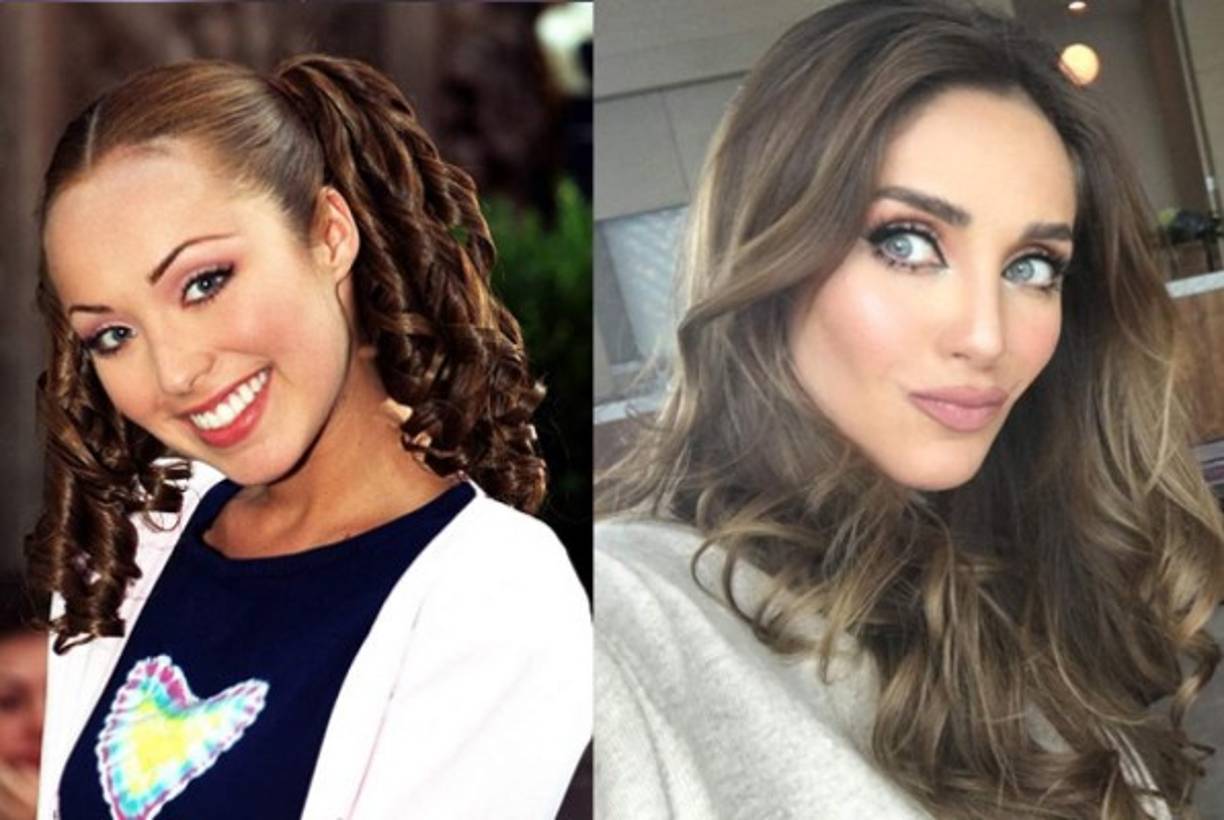 4. Anahí admitió en el 2011 haberse operado la nariz para corregir un tabique desviado que le impedía respirar bien. Confieza que aprovechó la cirugía para también corregir la estética de su nariz y mentón. Pero algunos preguntan ¿solo eso?