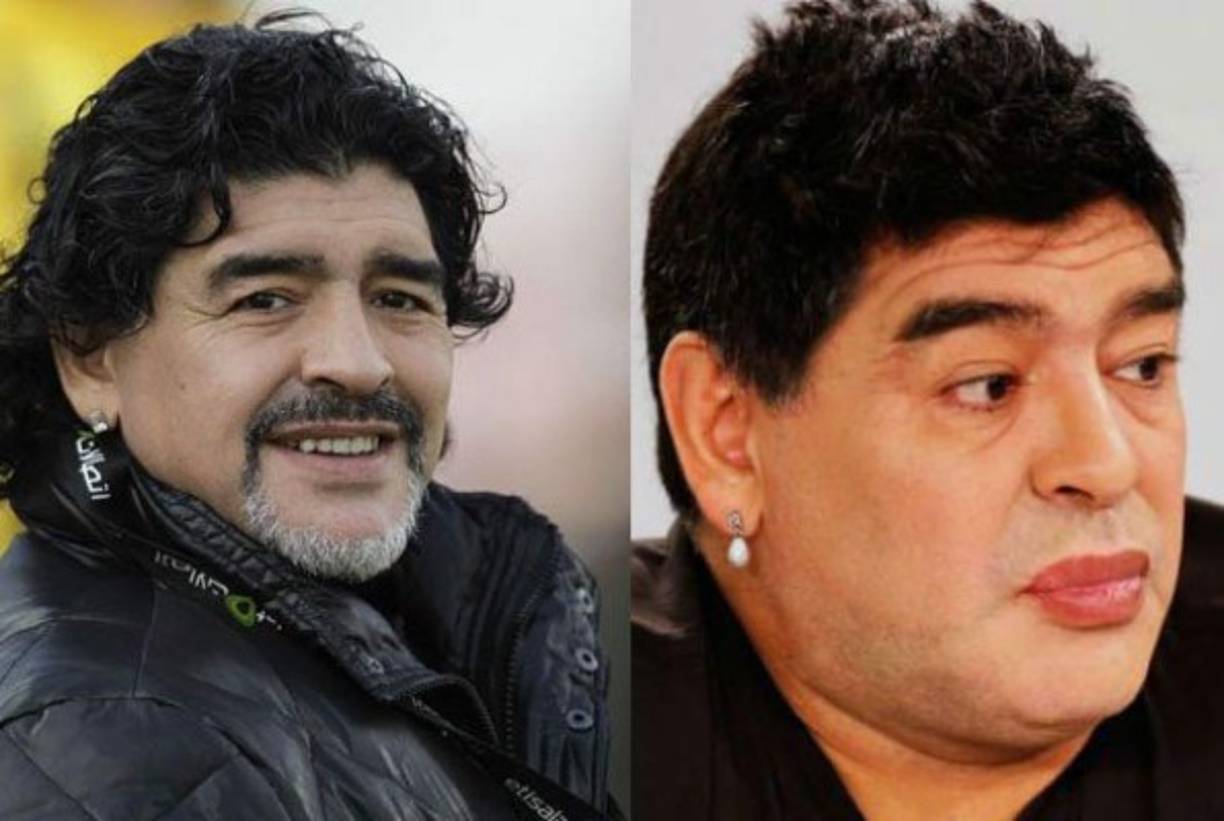 Diego Maradona: El astro argentino es otro de los que se ha hecho varias cirugías estéticas a lo largo de los últimos años.