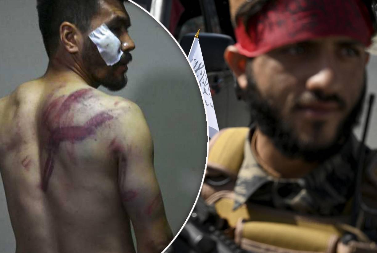 Taqi y Nematullah cubrían el miércoles en Kabul una manifestación para su periódico, pero su presencia no gustó a los talibanes, que los detuvieron durante cuatro horas y les dieron una brutal paliza.