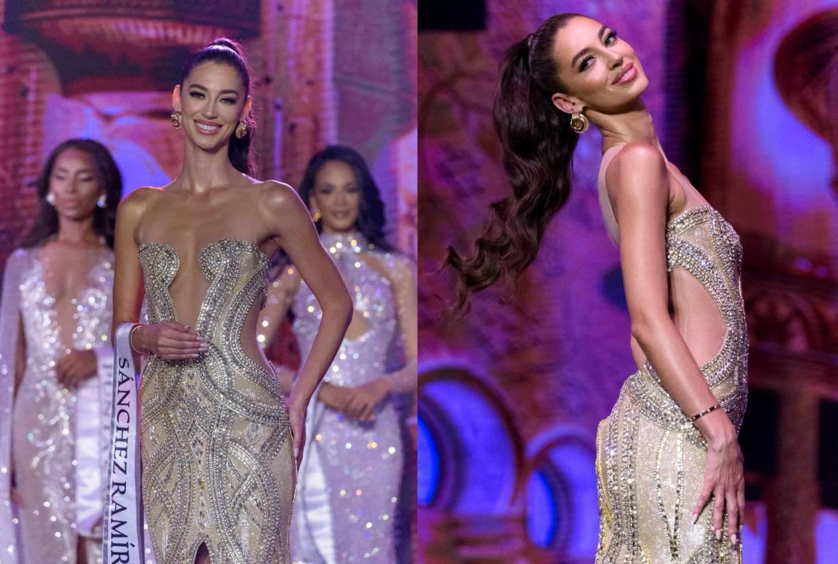 La modelo ha desarrollado su carrera principalmente en Estados Unidos y ha colaborado con marcas como Calvin Klein y Chanel.