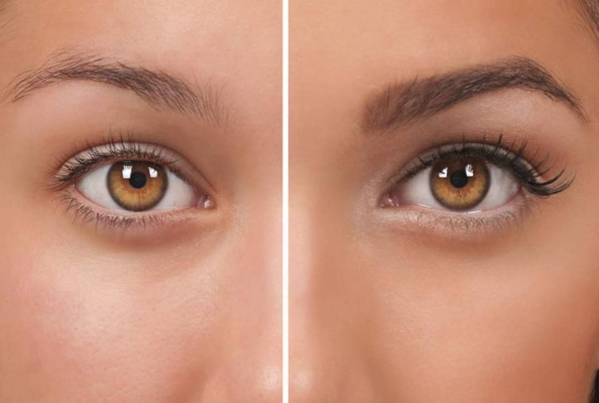¿Por qué tenemos cejas? Las cejas son una parte muy significativa del rostro. Expresan las emociones con tanta intensidad como los movimientos del cuerpo, y muchas personas dedican un tiempo considerable en arreglárselas. Funcionalmente, las cejas ayudan a la visión. Este arco de vellos desvían el agua y el sudor hacia los lados de la cara, lo que facilita el funcionamiento de los ojos cuando se está en la lluvia o cuando se está sudando.