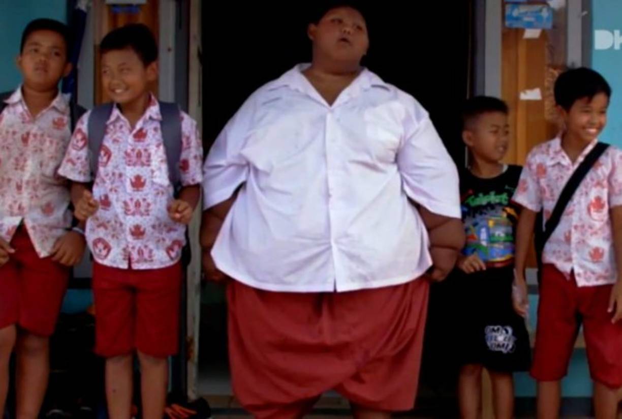 El pequeño tuvo que dejar el colegio debido a su sobrepeso y poca facilidad para movilizarse.