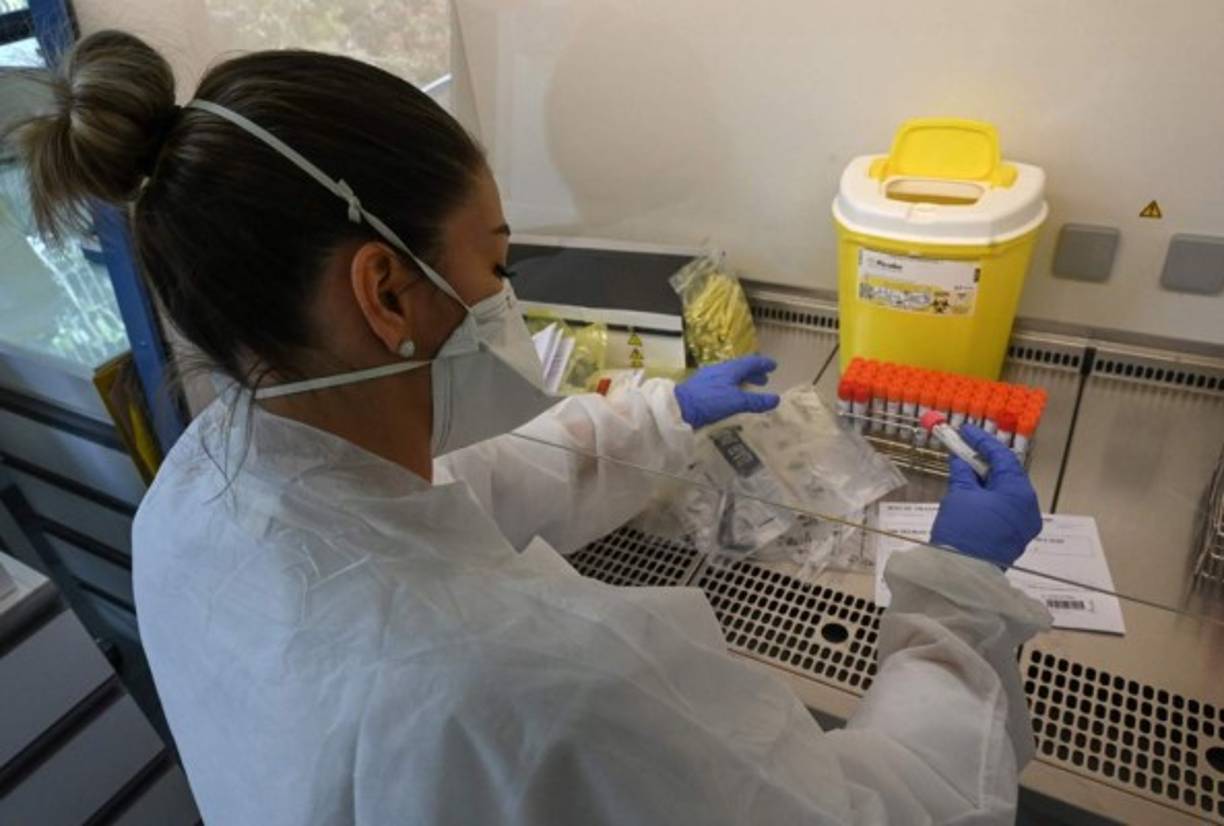 'Se necesitan más estudios para investigar si el virus detectado por PCR en tiempo real es capaz de transmitirse en las etapas posteriores de la infección por COVID-19', agregó Lixin Xie.