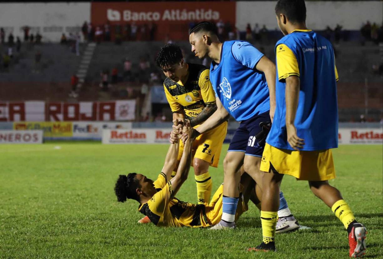 La decepción y tristeza en Real España era notoria. Sumaron su quinto partido sin ganar en la Liga Nacional. 