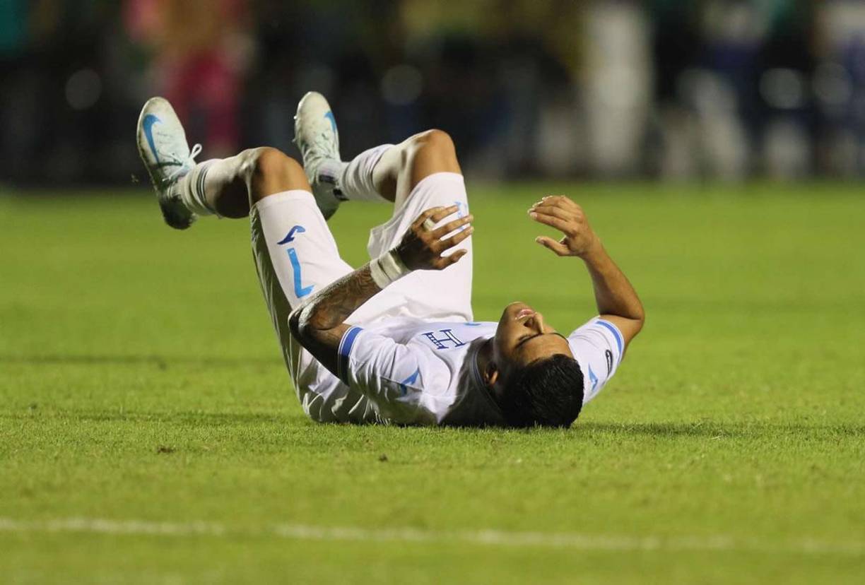 El delantero del Celtic Glasgow de Escocia estuvo apagado frente a la portería de Jamaica.