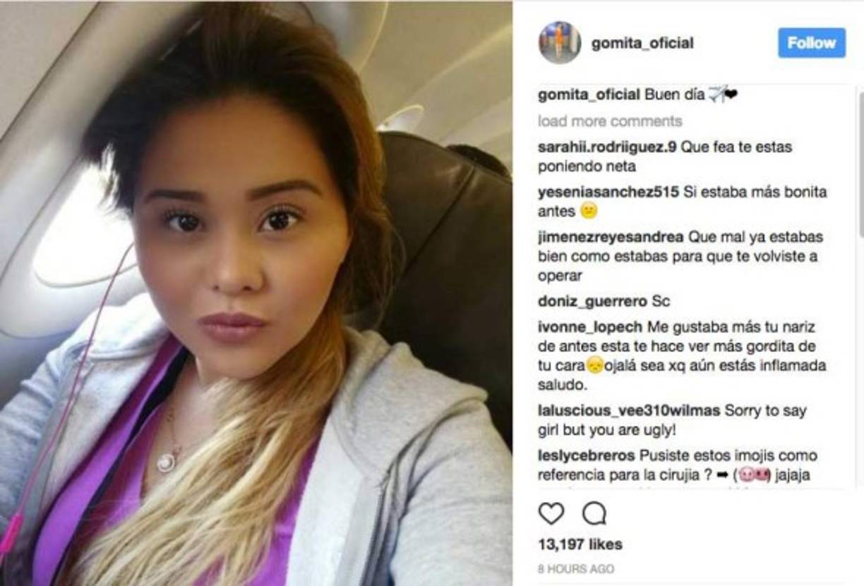 Antes de convertirse en la famosa payasita de 'Sabadazo', con apenas cuatro años de edad, animaba los bailes del grupo que tenía su padre, llamado 'Los Guairos'. Ahora el rostro de Gomita luce muy transformado debido a las múltiples cirugías a las que se ha sometido, tanto en su cuerpo como su cara.