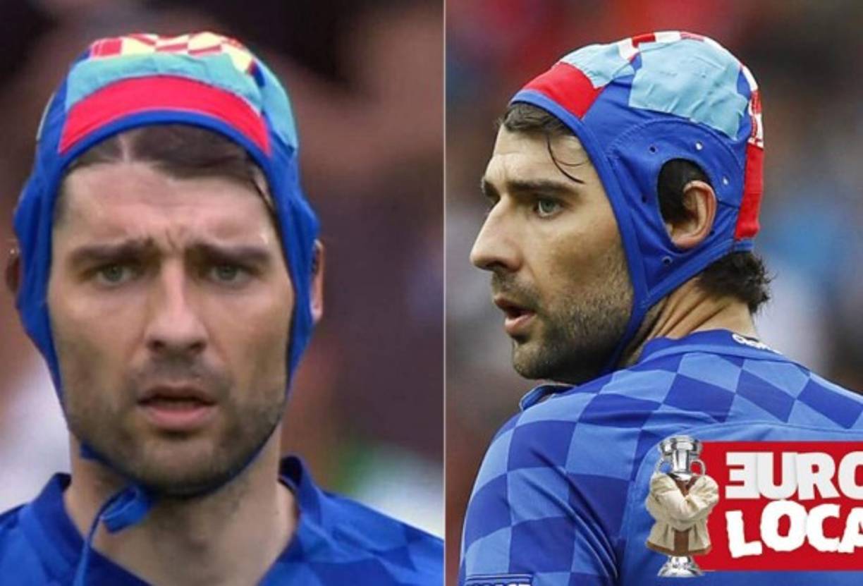 Corluka ha usado su gorro de waterpolo como improvisada protección para una herida en la cabeza en el partido anterior ante Républica Checa.