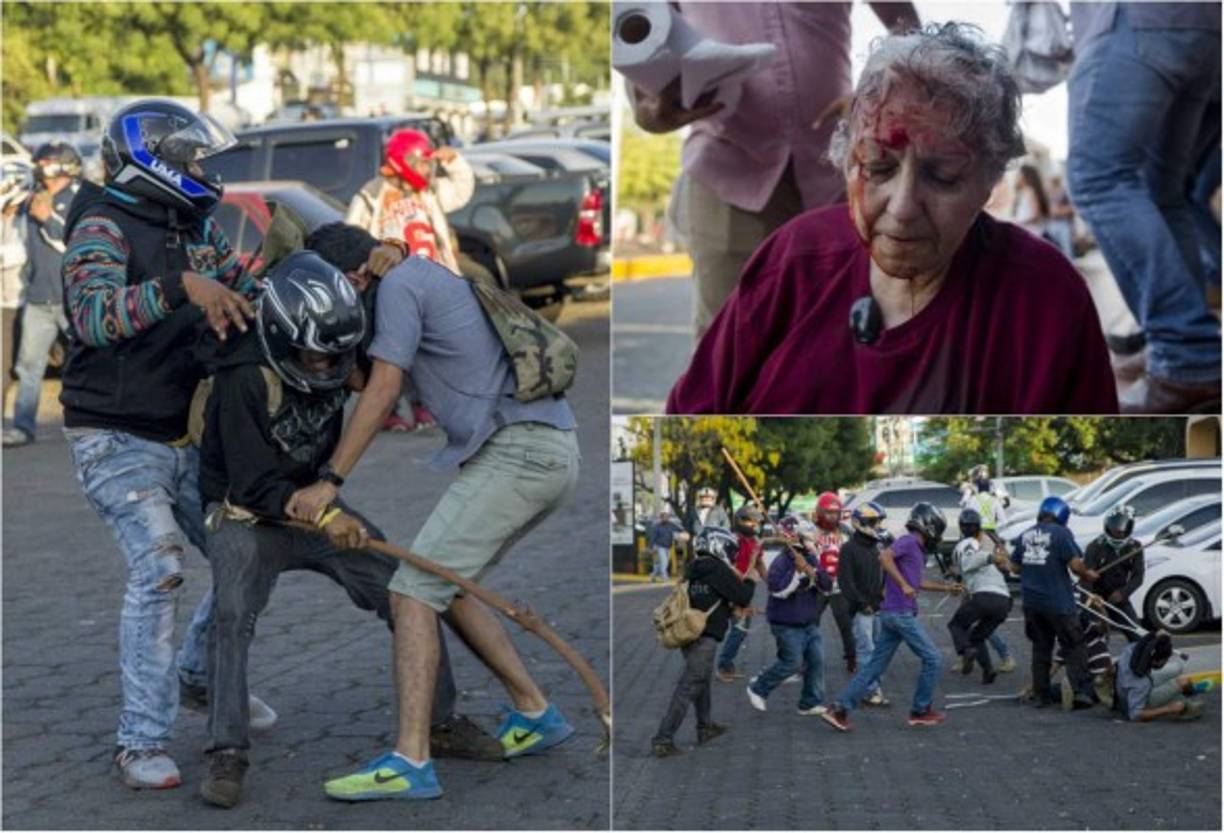 Decenas de personas resultaron heridas durante una protesta interrumpida por un grupo de personas que, con los rostros cubiertos por cascos de motociclistas, agredieron a manifestantes que se oponen a las reformas al Reglamento de la Ley de Seguridad Social, que aumenta la cuota patronal y laboral y crea una nueva cotización para los jubilados en Nicaragua.