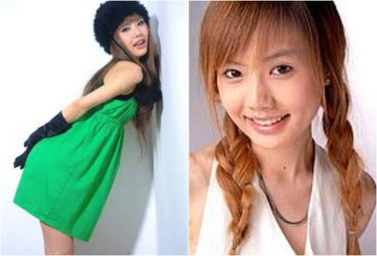 Wang Bei, de 24 años, quien se hizo famosa como concursante de 'Super Girl', la versión china del programa 'American Idol', sufrió un paro cardiorrespiratorio en la mesa de operaciones, del que no se pudo recuperar.