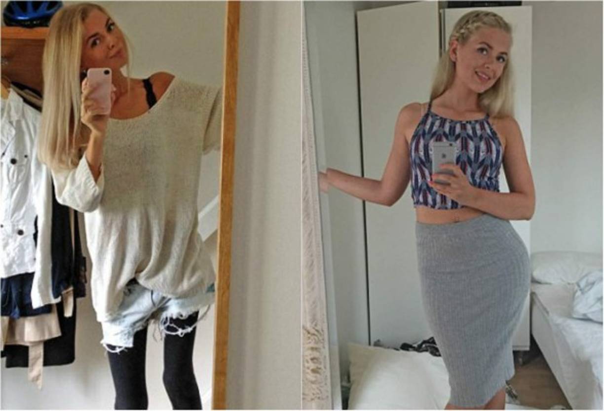 La joven ha logrado obtener un peso saludable, luego de sufrir una desnutrición severa a causa de la enfermedad.