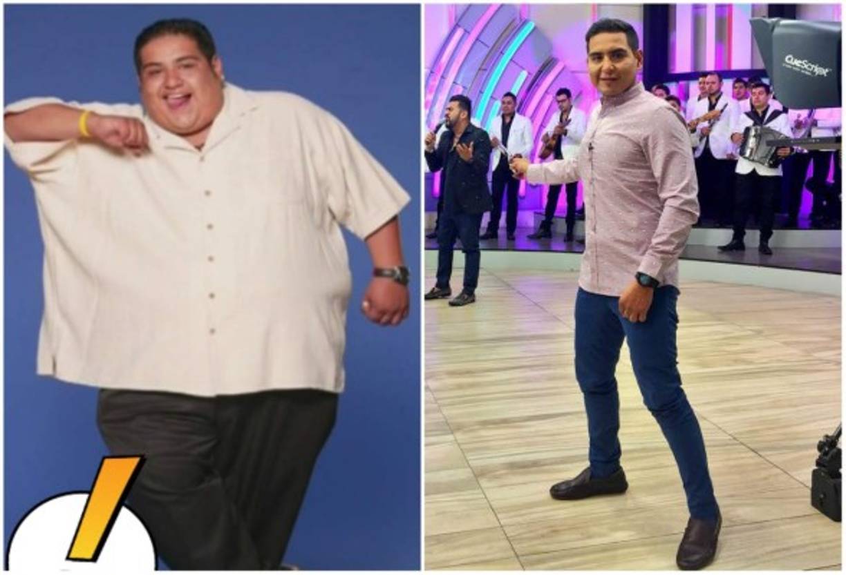 En total Rafael Balderrama se ha sometido a cuatro operaciones en su proceso para perder peso, incluyendo el bypass gástrico.<br/>