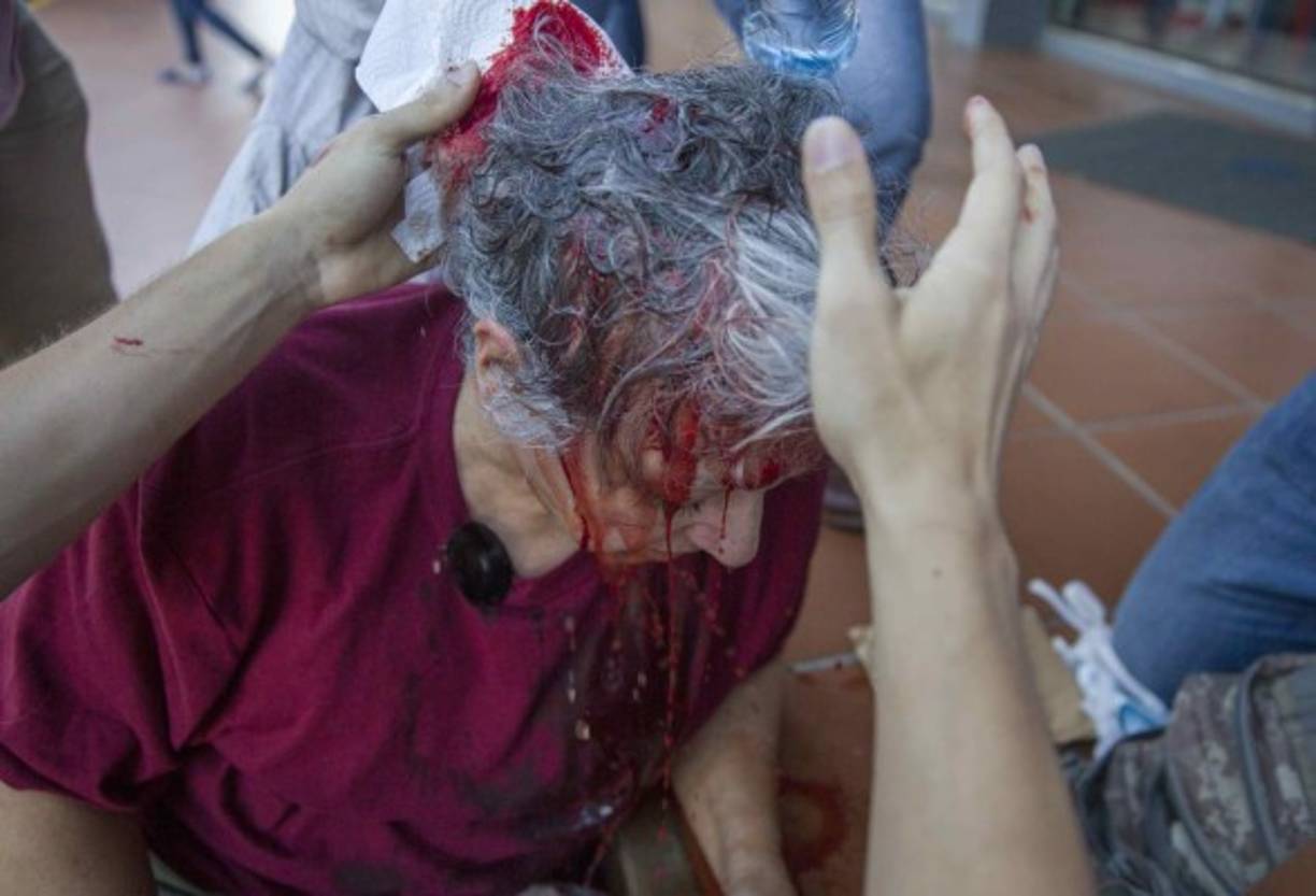 Las protestas iniciaron el miércoles cuando al menos 18 personas, entre ellos periodistas y adultos mayores, resultaron con heridas y golpes por objetos contundentes al ser sorprendidos por grupos de choque que se identifican con el gobierno.