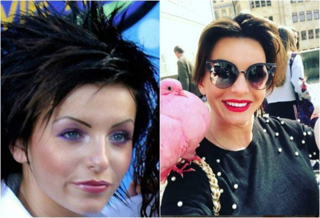 Las cirugías y el bótox la hacen ver irreconocible, su cambio es tan notable que a simple vista se aprecia que su apariencia no es cuestión de la edad.