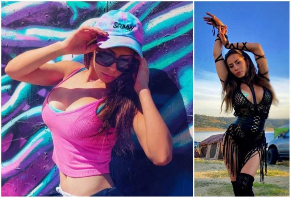 Tras sobrevivir a un accidente automovilístico, la actriz de cine para adultos Madison Ivy ha compartido sus avances en sus redes sociales y es impactante. <br/><br/>