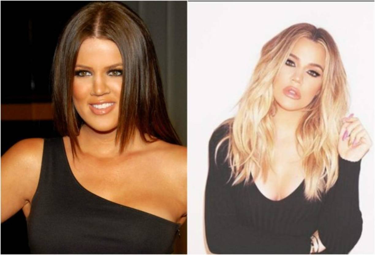 Su cambio físico es abismal en comparación con sus inicios en el mundo de las celebridades.